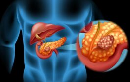 علماء اميركان يكشفون عن مسببات سرطان البنكرياس 