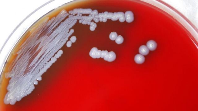 أمريكا تعلن العثور على بكتيريا قاتلة في البلاد 