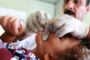 العراق يسجل ارتفاعا جديدا بوفيات وإصابات الكوليرا والحمى النزفية 