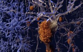 العلماء يكشفون عن أدلة جديدة على الآلية الرئيسية في مرض ألزهايمر 